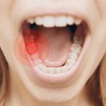 cách giảm đau răng tại nhà