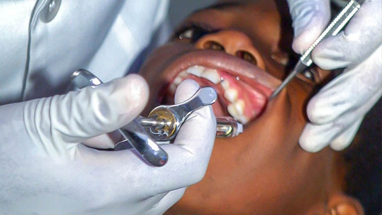 phẫu thuật áp xe răng