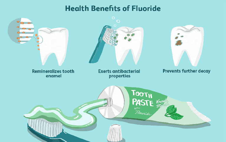 fluor ngừa sâu răng