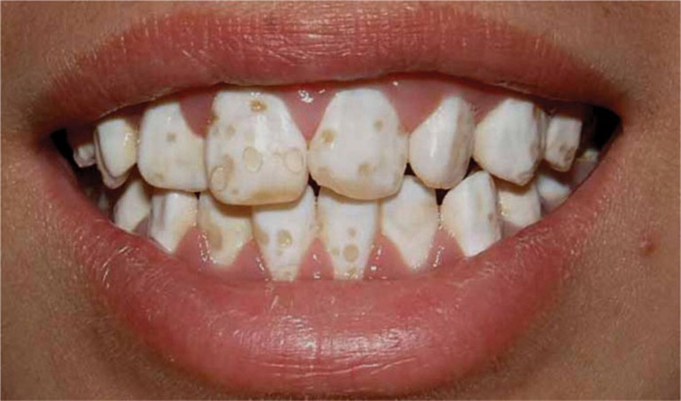 chức năng men răng 