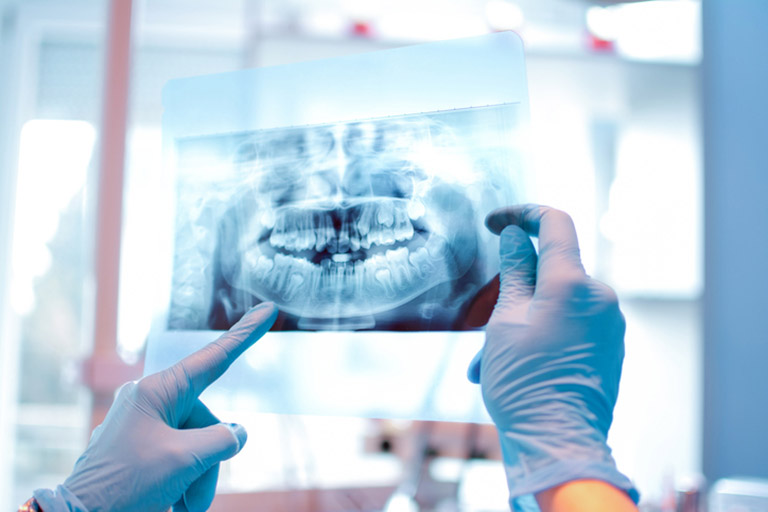 Chụp x quang răng có hại gì không