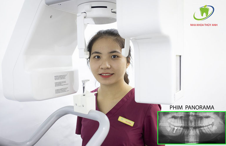 địa chỉ chụp x quang răng ở hà nội địa chỉ chụp x quang răng ở hà nội