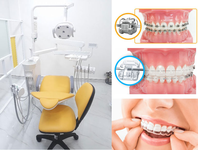 Niềng răng tại Bệnh viện Răng Hàm Mặt Trung Ương nhận được nhiều phản hồi tích cực từ khách hàng
