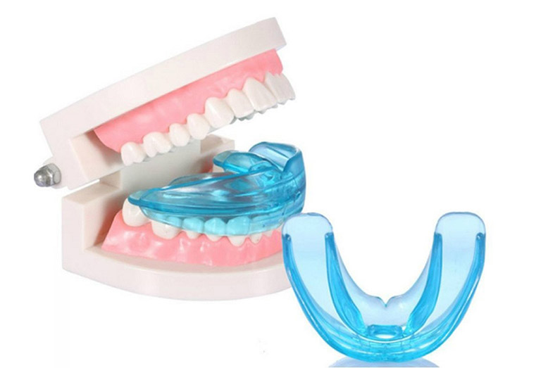Niềng răng bằng nhựa