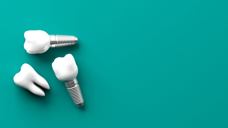 biến chứng trồng răng implant