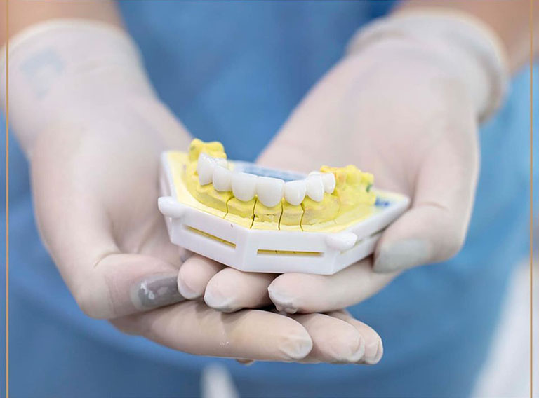 công nghệ bọc răng sứ majestic nano 5k