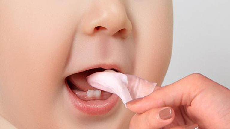 cách chữa bệnh nhiệt miệng cho trẻ sơ sinh