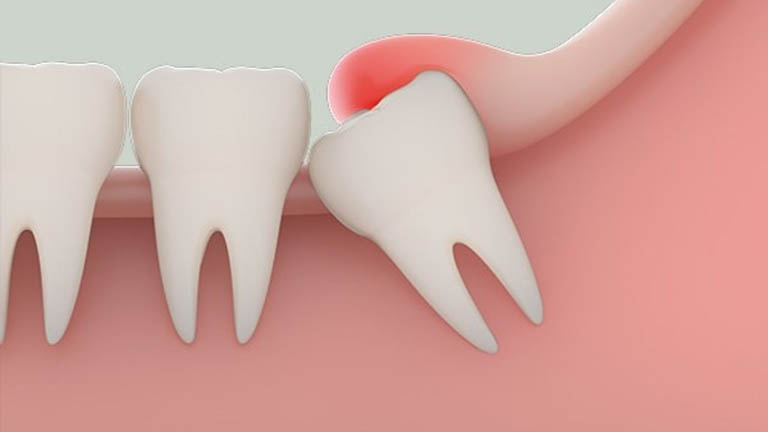 vị trí các răng hàm dưới