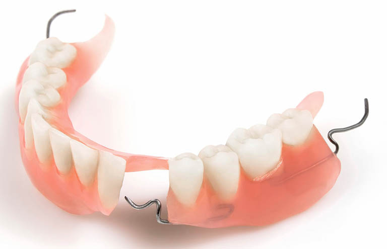 trồng răng giả là gì