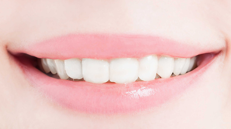 Những cách lấy cao răng tại nhà đơn giản, an toàn và mang đến hiệu quả cao