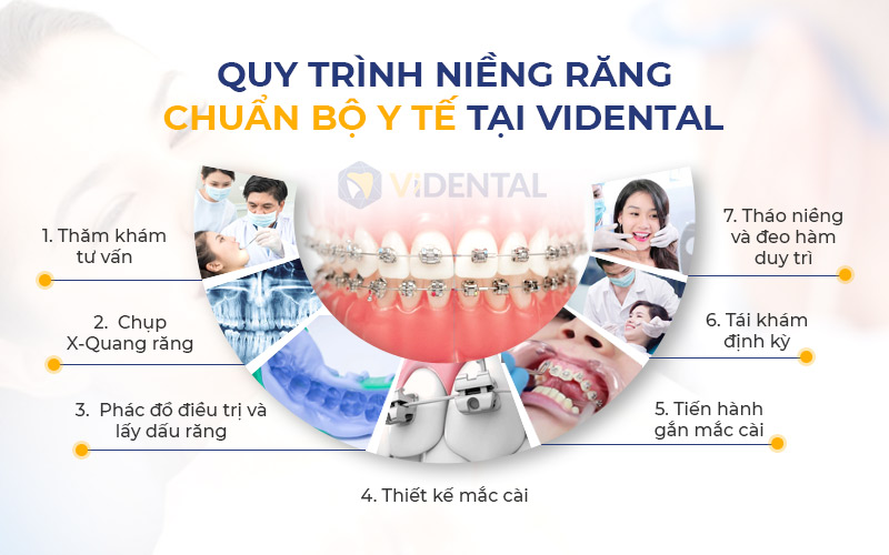 Quy trình niềng răng đạt chuẩn Bộ Y tế
