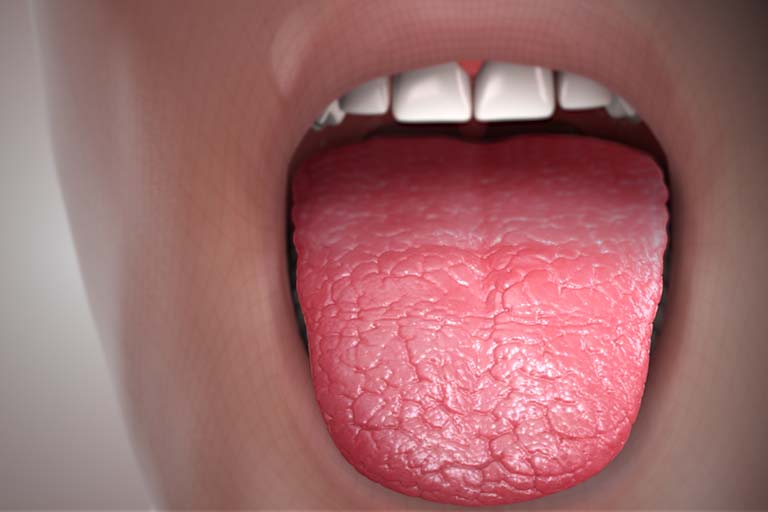 triệu chứng khô miệng rát lưỡi