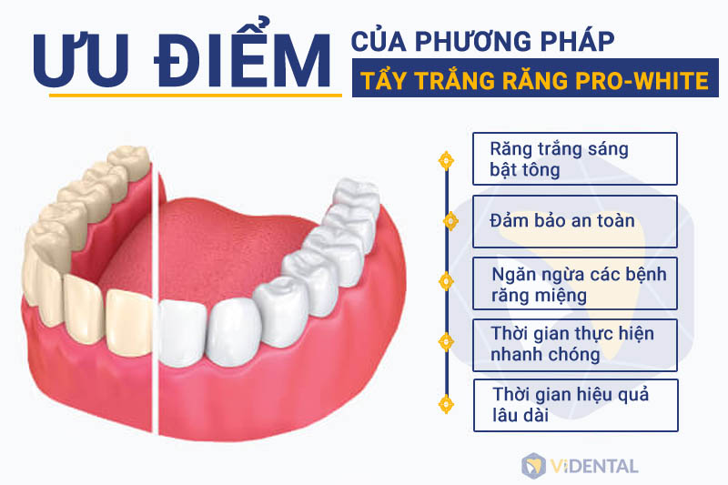 Ưu điểm của phương pháp tẩy trắng răng công nghệ cao PRO-WHITE.