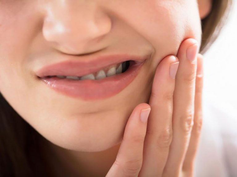 răng khôn mọc ngầm trong xương