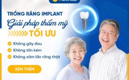 trụ Implant