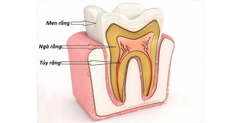 Lộ ngà răng là gì?