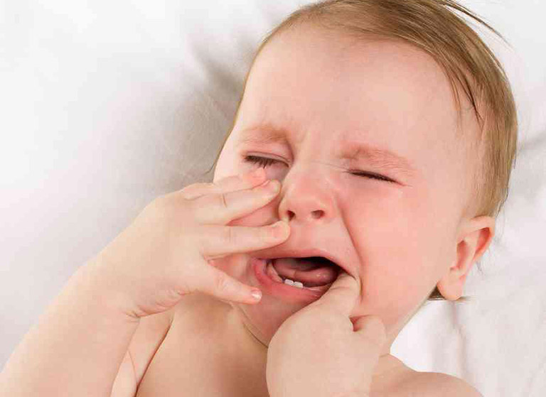 Mọc răng là nguyên nhân khiến trẻ bị viêm lợi và sốt