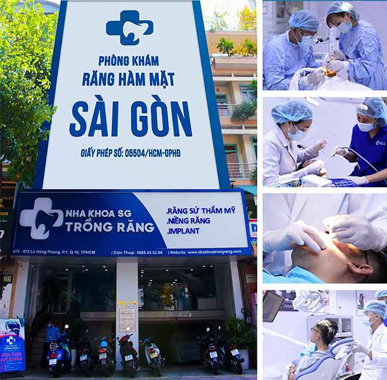 Nha khoa Trồng Răng Sài Gòn