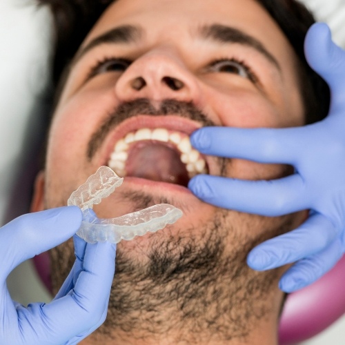 Niềng răng Invisalign mang đến nhiều ưu điểm vượt trội