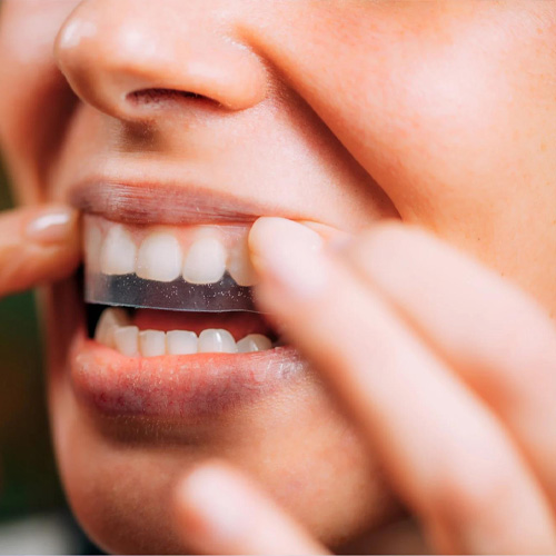 Nếu không thận trọng có thể gây nhiều tác hại cho răng
