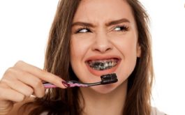 Vạch Trần Hiệu Quả Tẩy Trắng Răng Tại Nhà Thực Sự Tốt?