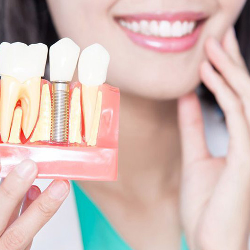 Răng giả có thể duy trì được hơn 20 năm