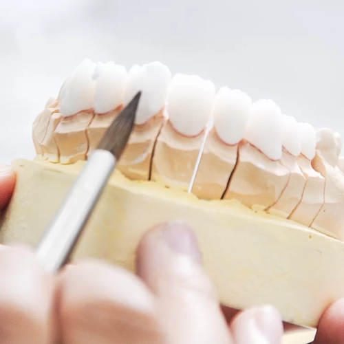 Thời gian bọc răng sứ phần lớn phụ thuộc vào số lượng răng cần bọc 