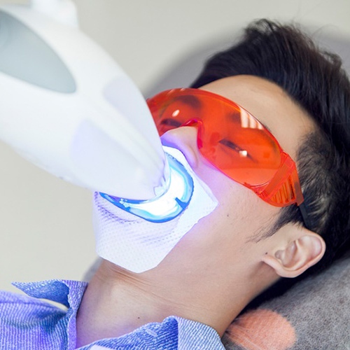 Laser Whitening - Công nghệ tẩy trắng răng vượt trội 