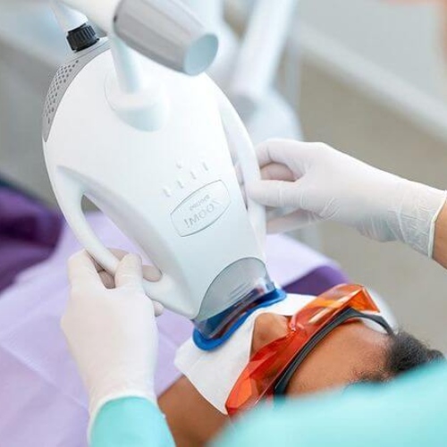Công nghệ tẩy trắng Laser Zoom giúp loại bỏ triệt để các vết ố màu trên răng 