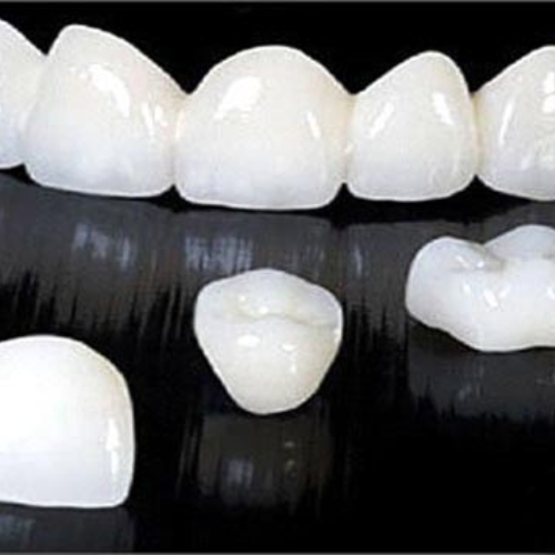 Răng sứ Ceramill mang đến hiệu quả điều trị cao