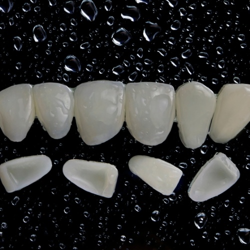 Tổng quan thông tin về răng sứ Zirconia và Cercon