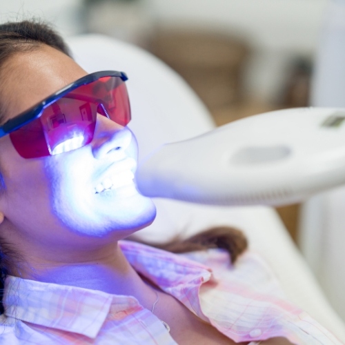 Tẩy trắng bằng Laser giúp răng duy trì trắng sáng lâu dài