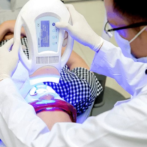 Tẩy trắng răng công nghệ cao tại nha khoa Kim 